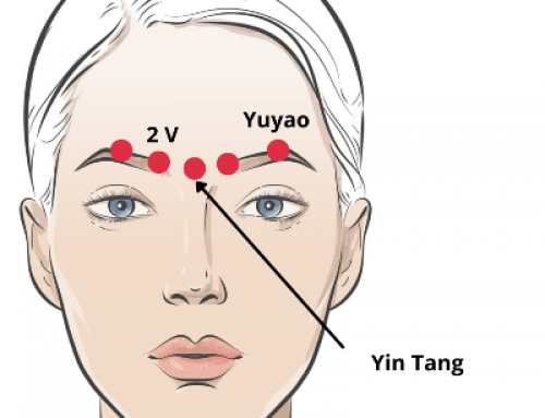 Fatigue, yeux sensibles et mal de tête : le point 2 du méridien de la vessie soulage le front et le visage.